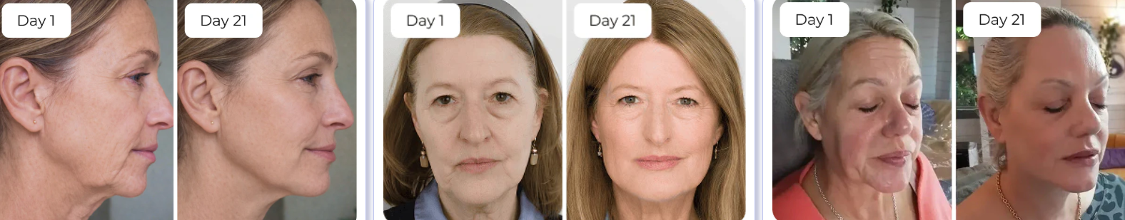 Naraskin Lab Benefits