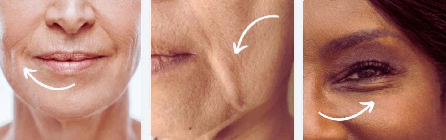 South Beach Collagen Filler Serum Advantage