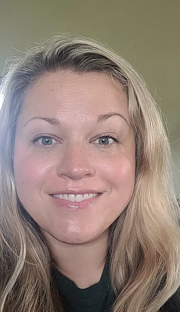 South Beach Collagen Filler Serum Customer 2