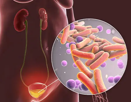 UroFresh Benefits