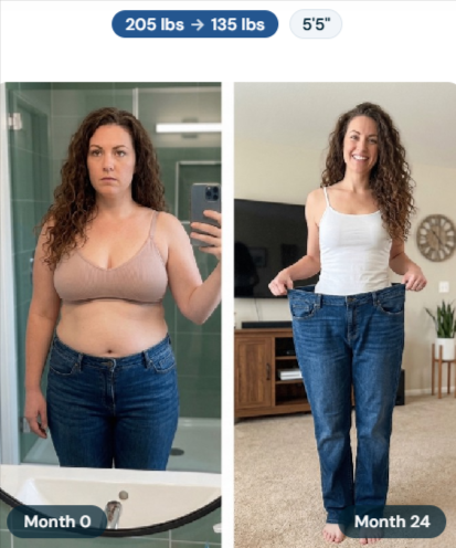 Trimi GLP-1 Before & After